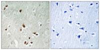 HDAC5/9 Polyclonal Antibody
