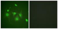 HDAC6 Polyclonal Antibody