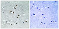 HDAC6 Polyclonal Antibody