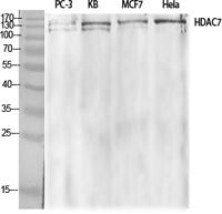 HDAC7 Polyclonal Antibody