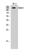 HDAC7 Polyclonal Antibody