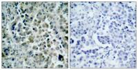 HDAC8 Polyclonal Antibody
