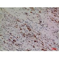HDC Polyclonal Antibody