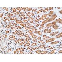 HDC Polyclonal Antibody