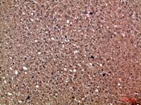 HDGF Polyclonal Antibody