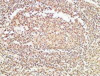 HDGF Polyclonal Antibody