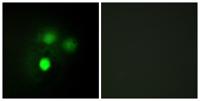 Hec1 Polyclonal Antibody