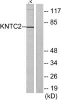 Hec1 Polyclonal Antibody