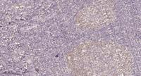 HECD1 Polyclonal Antibody