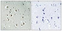 HEI10 Polyclonal Antibody