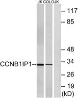 HEI10 Polyclonal Antibody