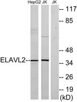 Hel-N1 Polyclonal Antibody