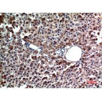 Hepassocin Polyclonal Antibody
