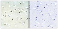 S-100A16 Polyclonal Antibody