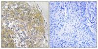 S-100A16 Polyclonal Antibody