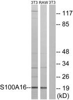 S-100A16 Polyclonal Antibody