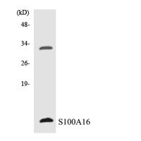 S-100A16 Polyclonal Antibody