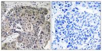 S-100A3 Polyclonal Antibody