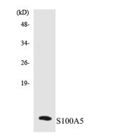 S-100A5 Polyclonal Antibody