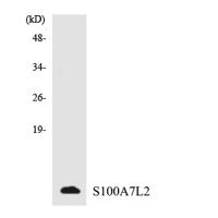 S-100A7L2 Polyclonal Antibody