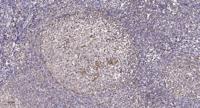 AIM2 Polyclonal Antibody