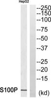 S-100P Polyclonal Antibody