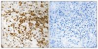 S-100P Polyclonal Antibody
