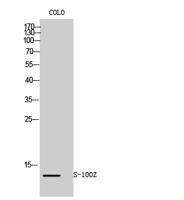 S-100Z Polyclonal Antibody