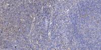 S-100Z Polyclonal Antibody
