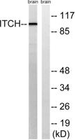 AIP4 Polyclonal Antibody