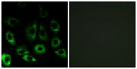 S2P Polyclonal Antibody