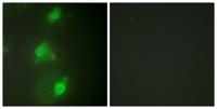 AIRE-1 Polyclonal Antibody