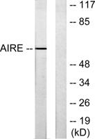 AIRE-1 Polyclonal Antibody