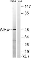 AIRE-1 Polyclonal Antibody