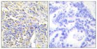 AK1 Polyclonal Antibody