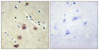 AK5 Polyclonal Antibody