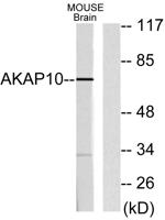 AKAP 10 Polyclonal Antibody