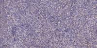 AKAP 10 Polyclonal Antibody