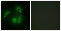 AKAP 14 Polyclonal Antibody
