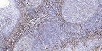 AKAP 14 Polyclonal Antibody