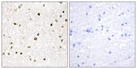 AKAP 220 Polyclonal Antibody