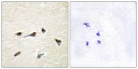 AKAP 250 Polyclonal Antibody