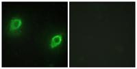 AKAP 79 Polyclonal Antibody