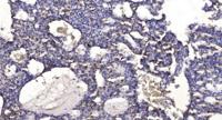 SAP 155 Polyclonal Antibody