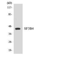 SAP 49 Polyclonal Antibody