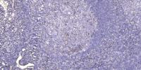 SAP 49 Polyclonal Antibody