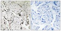 Sar1B Polyclonal Antibody