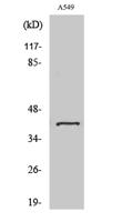 Sarcoglycan-β Polyclonal Antibody