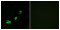 ACOT1 Polyclonal Antibody
