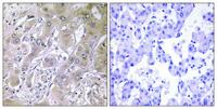 ACOT12 Polyclonal Antibody